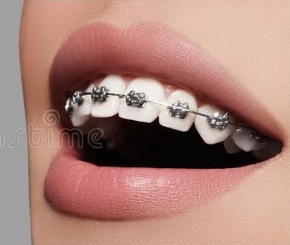 <span style="font-weight: bold;">ORTODONCIA</span>&nbsp;